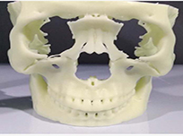 术前指导模型-面部骨骼创伤修复